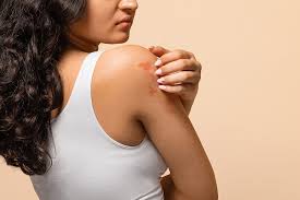 Image result for Skin Infection