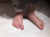Maybe you would like to learn more about one of these? Fussfehlstellungen Bei Kindern Die Gehwerkstatt