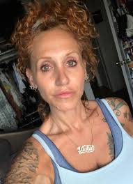 Best Botox and filler