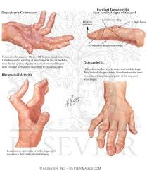 Image result for Hand Exam
