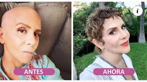 En 2017, la actriz Rebecca Jones recibió uno de los diagnósticos más  aterradores para una mujer: cáncer de ovario. Rebecca contó que todo  comenzó con una inflamación inusual del vientre, por la