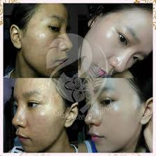 Jadi kulit masih menyesuaikan diri dengan skincare baru. For All Costumer Ms Glow Yg Anis Ms Glow Jombang Facebook
