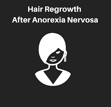 The rate of hair loss and hair regrowth in people with anorexia will depend on several different factors, including their level of malnourishment, age, gender, and genetic makeup. Hair Regrowth After Treatment For Anorexia Nervosa Donovan Hair Clinic