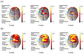 Nirx Medical Tech On Twitter Curious About How Nirx Systems Were Used In Measuring How Symptoms Of Parkinson S Disease Change After Acupuncture Treatment Find Out From This Recent Pilot Study Here Https T Co Mle0kur9wk