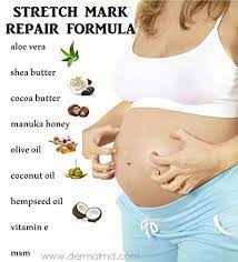 Pin On Get Rid Of Stretch Marks