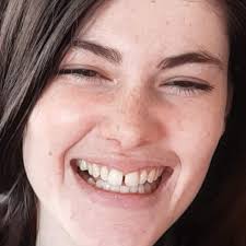 So I haven't decided wether to go for clear correct yet but looking at the  before & after it's the gaps beside my two front teeth at the end that's  putting me