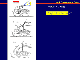 We sell high octane no ethanol gas at reasonable prices. Ppt Safe Entry In Laparoscopy Powerpoint Presentation Free Download Id 2208525
