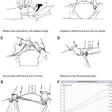 method of fundal height measurement download scientific