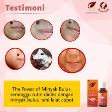 Places malacca city beauty, cosmetic & personal carebeauty salonhair salon hilangkan tahi lalat, kutil, ketuat by. Minyak Bulus Asli Obat Penghilang Tahilalat Ampuh Obat Penghilang Tahilalat Di Muka Obat Penghilang Tahilalat Hidup Obat Penghilang Tahilalat Bpom Obat Penghilang Kutil Dileher Obat Penghilang