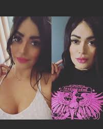 Dr. Luis Pablo Canul Andrade (@dr_canulandrade) • Instagram photos and  videos