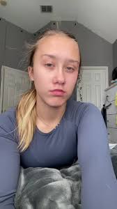 Resting B Face Example