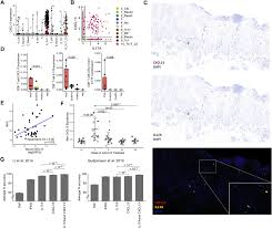 Computing the book profits of the company. Single Cell Rna Sequencing Of Psoriatic Skin Identifies Pathogenic Tc17 Cell Subsets And Reveals Distinctions Between Cd8 T Cells In Autoimmunity And Cancer Journal Of Allergy And Clinical Immunology