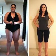gastric sleeve before and after