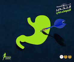 عملية تصغير المعدة لـ حل مشكلة الجوع المستمر movie posters movies poster