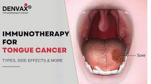Image result for cancer tongue symptoms)