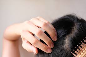iron deficiency causing your hair loss