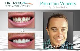 Dr. Rob Barrick The Smile Artist