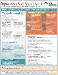 If you aren't sure which type of skin cancer. Asds Releases Squamous Cell Carcinoma Recommendations Squamous Cell Squamous Cell Carcinoma Squamous