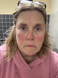 Anyone know of a REALLY good specialized rheumatologist I need a very  understanding one that listens and is willing to go the extra mile and am  willing to travel outside the brunswick