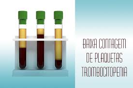 This condition, in which you have a low blood platelet count, can cause bleeding and bruising. Novo Tratamento De Trombocitopenia Medicsupply
