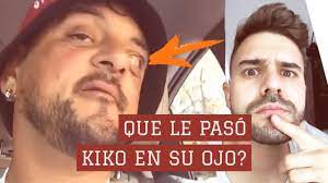 QUÉ LE PASÓ A KIKO DE ZONA SUR EN EL OJO?👀 (VIDEO QUE JAMÁS VISTE) 