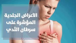 الأعراض الجلدية المؤشرة على سرطان الثدي والأمراض الجلدية المصاحبة للمصابات فيه Youtube