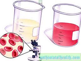 Minum air dengan cukup dan jangan terlebih kandungan air, kerap pergi ke tandas dan mengamalkan pemakanan yang sihat adalah faktor yang membantu anda untuk mendapatkan air kencing. Apakah Maksud Warna Kencing Apa Warna Air Kencing Seseorang Yang Sihat Ubat 2021