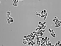 Image result for Buchnera candida