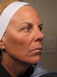 Clinical Casebook M22™ Treatments