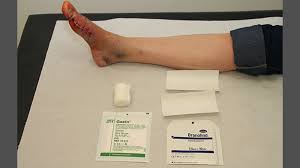 Wundheilung Und Verbandswechsel Wuppertaler Fuss Initiative