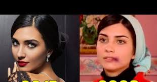 Tuba Buyukustun De Estetik Varmis Kizlarsoruyor