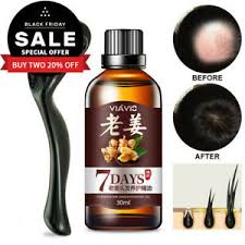 This hair growth oil helps regenerate lost hair and strengthens the strands to prevent breakage or further hair fall. 7 Days Hair Regrowth Serum Ginger Oil 0 5mm Derma Micro Needle Titanium Roller Ebay
