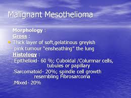Malignant pleural mesothelioma, biphasic pt3;n2. Tumors Of Lung And Pleura Tumors Of The
