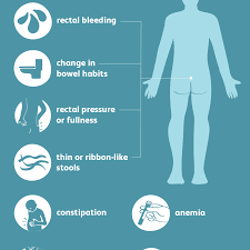 Read about the symptoms of bowel cancer. Rectal Cancer Symptoms And Signs