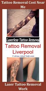 Is Laser Tattoo Removal Safe Tattoo Removal Blisters Tattoo Kits Can Water Fasting Remove Tattoos Tattoo Tattoo Removal Cost Laser Tattoo Laser Tattoo Removal