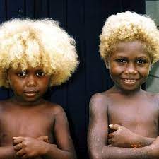 With their aquiline noses, high cheekbones (often with blonde or reddish hair), they are said to resemble their alleged atlantean ancestors—many individuals are over six feet tall. Being A Nigerian Lady That Might Not Want Children Olotu Funke Black And Blonde Black Hair Blue Eyes Melanesian People