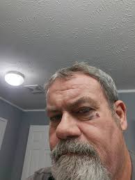 Removing Splinters with Dental Floss and Glue