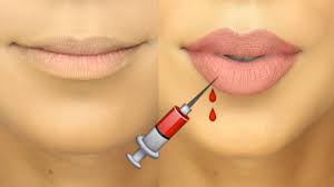 How do i make my lips appear bigger? How To Make Small Lips Look Bigger No Lip Filler Youtube