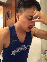 Cô ấy hẳn rất cứng cỏi và tự lập mới có thể vượt qua một năm đầy xáo trộn. Cao Thai SÆ¡n Ä'i Cáº¥p Cá»©u Luc Ná»­a Ä'em