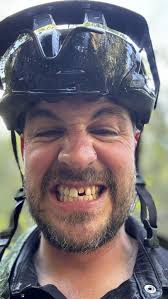 Accidents aur injuries kitne common hain, sach mein? : r/MTB