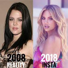 Photographer exposes instagram vs reality photos pt. Khloe Kardashian Instagramreality