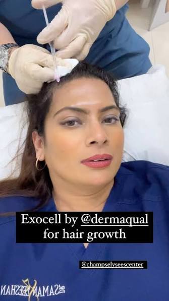 Serum being applied to the scalp