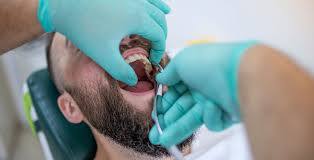 Image result for Tooth Extraction