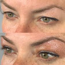Today's AMAZING EYELID LIFT treatment with the Plasma Pen - photo of Before  and immediately after treatment (ALL Photos are my work) Do your Hooded  Eyelids bother you? If so read on &hellip;