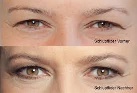 Haben sie sich schon immer gefragt, welche farben sie auf ihre augenlider auftragen können, um ihren look zu sublimieren? Schlupflider Schminken Aktuell 2021 Richtig Kaschieren Anleitung