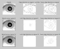 A sigma of 1.4 is used in this example and was determined through trial and. Edge Detection By Canny And Laplacian Of Gaussian Log Methods Download Scientific Diagram