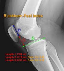 Image result for Patella Mobility Test