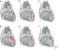 The coronary arteries wrap around the outside of the heart. Figure 2 Surgical And Physiological Challenges In The Development Of Left And Right Heart Failure In Rat Models Springerlink