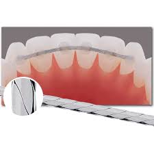 The wire part wraps around all or part of your teeth. Braided Retainer Wire Ortho Technology
