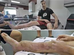 Alex smith's nfl career could be over. Alex Smith Says Docs Surgically Moved His Quad Muscle Into Shin To Save Leg